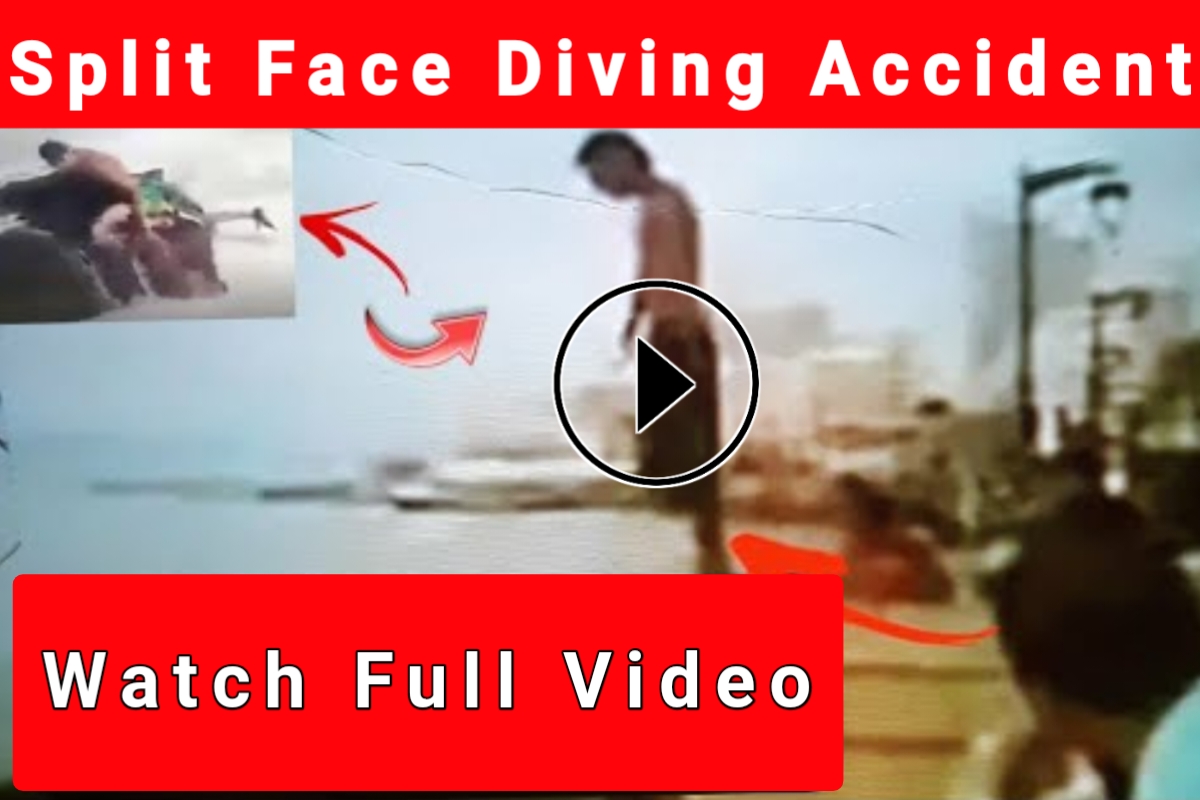 Split Face Diving Accident, split face diving accident full video,diving accidents are serious incidents our attention and caution